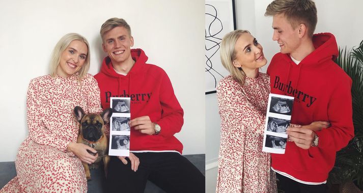 Runar Alex Runarsson and his girlfriend Asdis Bjork while revealing their pregnancy. (Credit: Instagram)