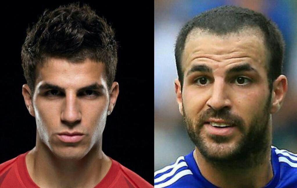 Cesc Fabregas before and after his hair transplant. (Credit: Twitter)
