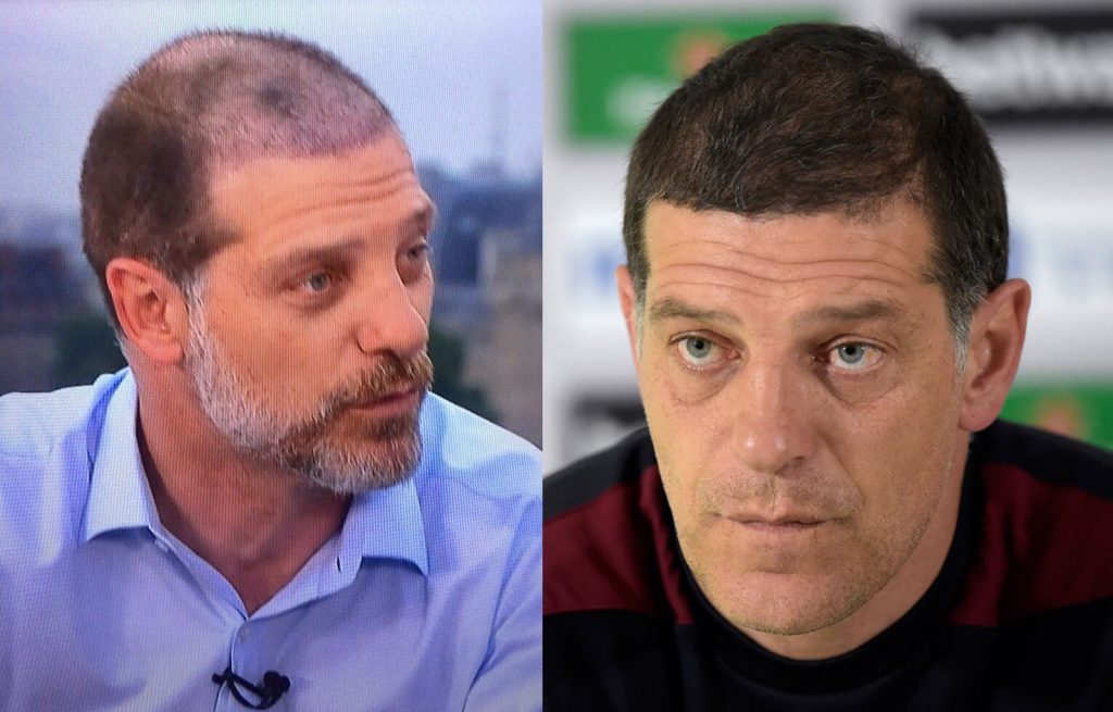 Slaven Billic before and after his hair transplant. (Credit: Twitter)
